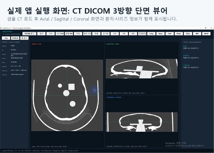 MediView CT DICOM 뷰어 실제 화면