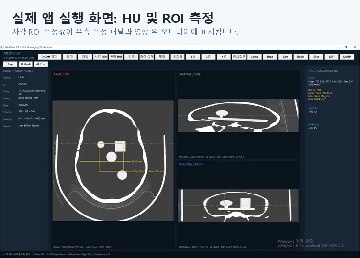 MediView CT DICOM 뷰어 구현 화면 2