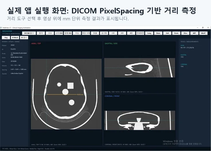 MediView CT DICOM 뷰어 구현 화면 3