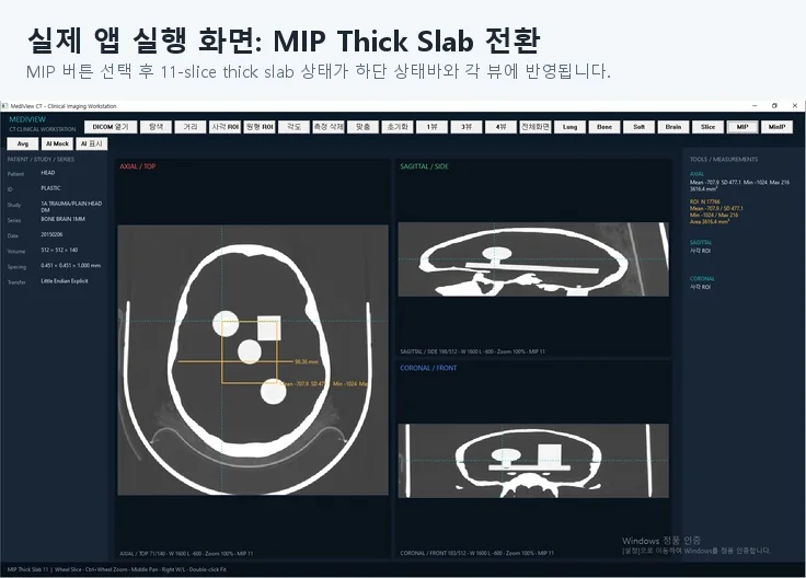MediView CT DICOM 뷰어 구현 화면 4