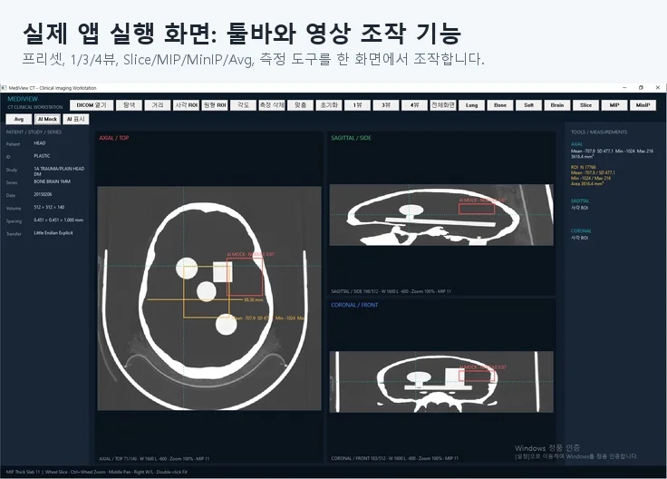 MediView CT DICOM 뷰어 구현 화면 5